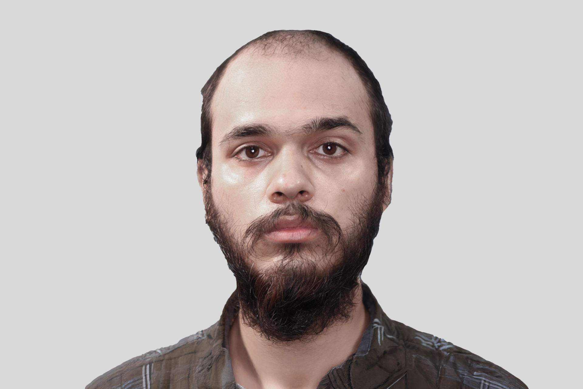 Before Surgery Image