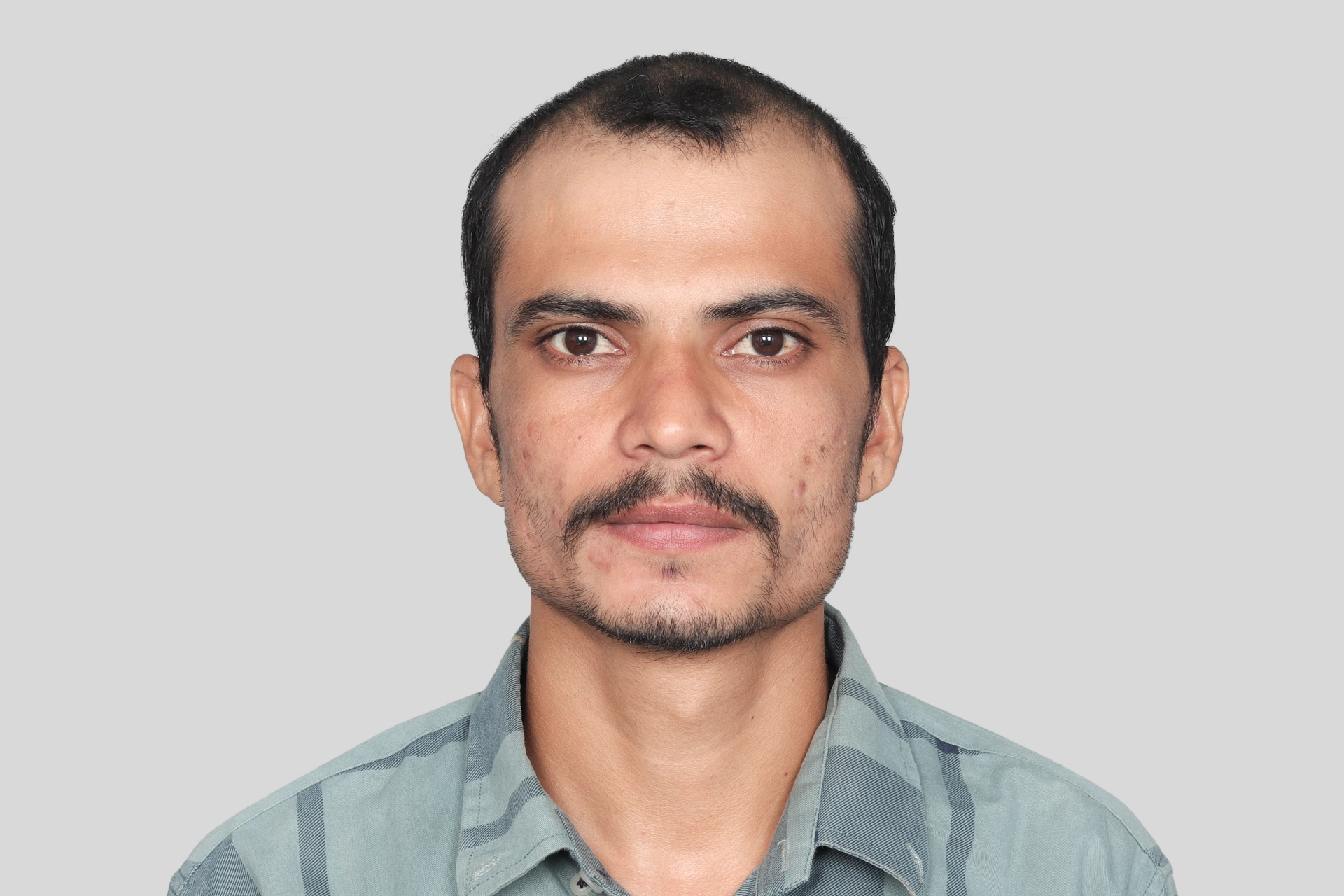 Before Surgery Image