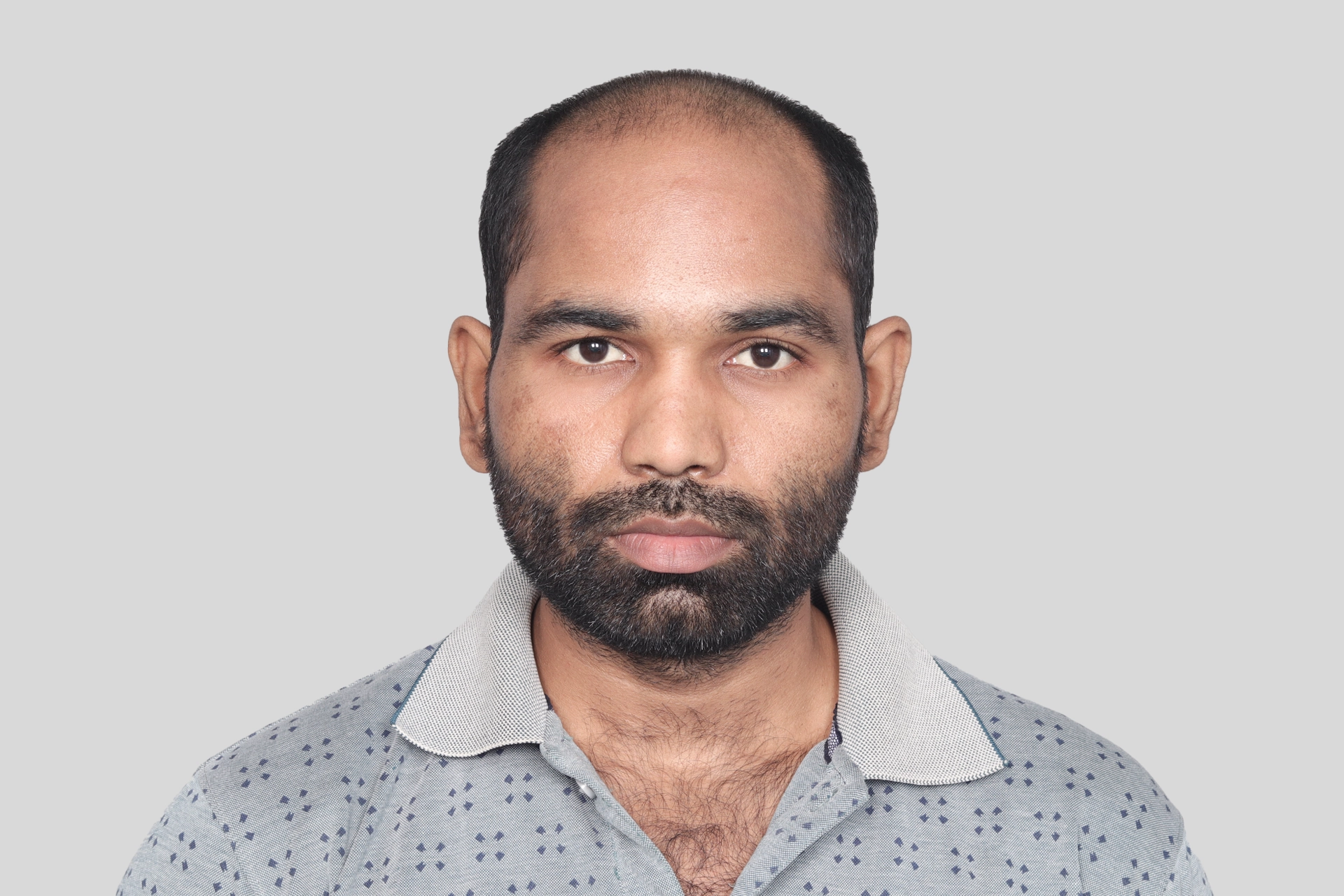 Before Transplant Image