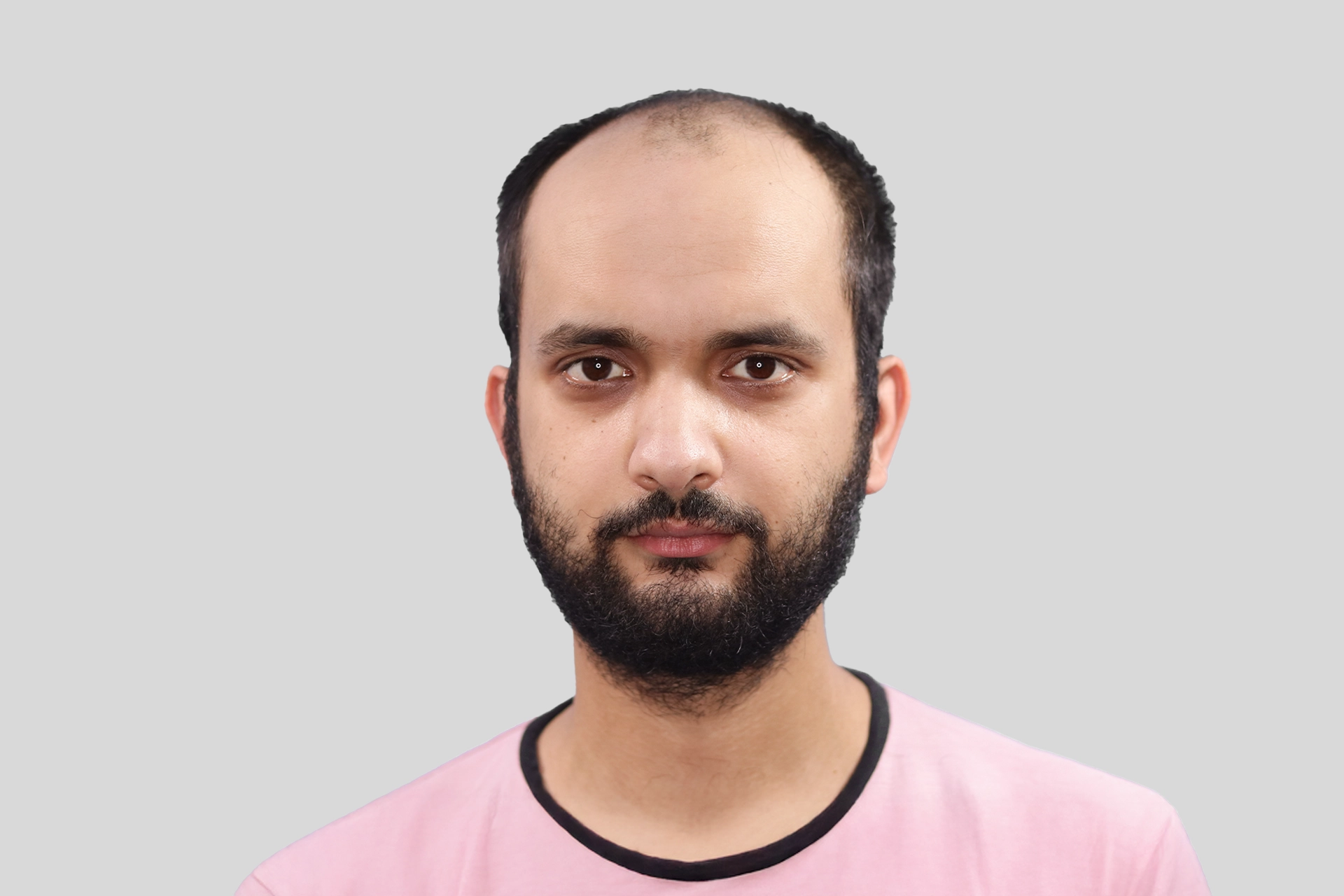 Before Transplant Image