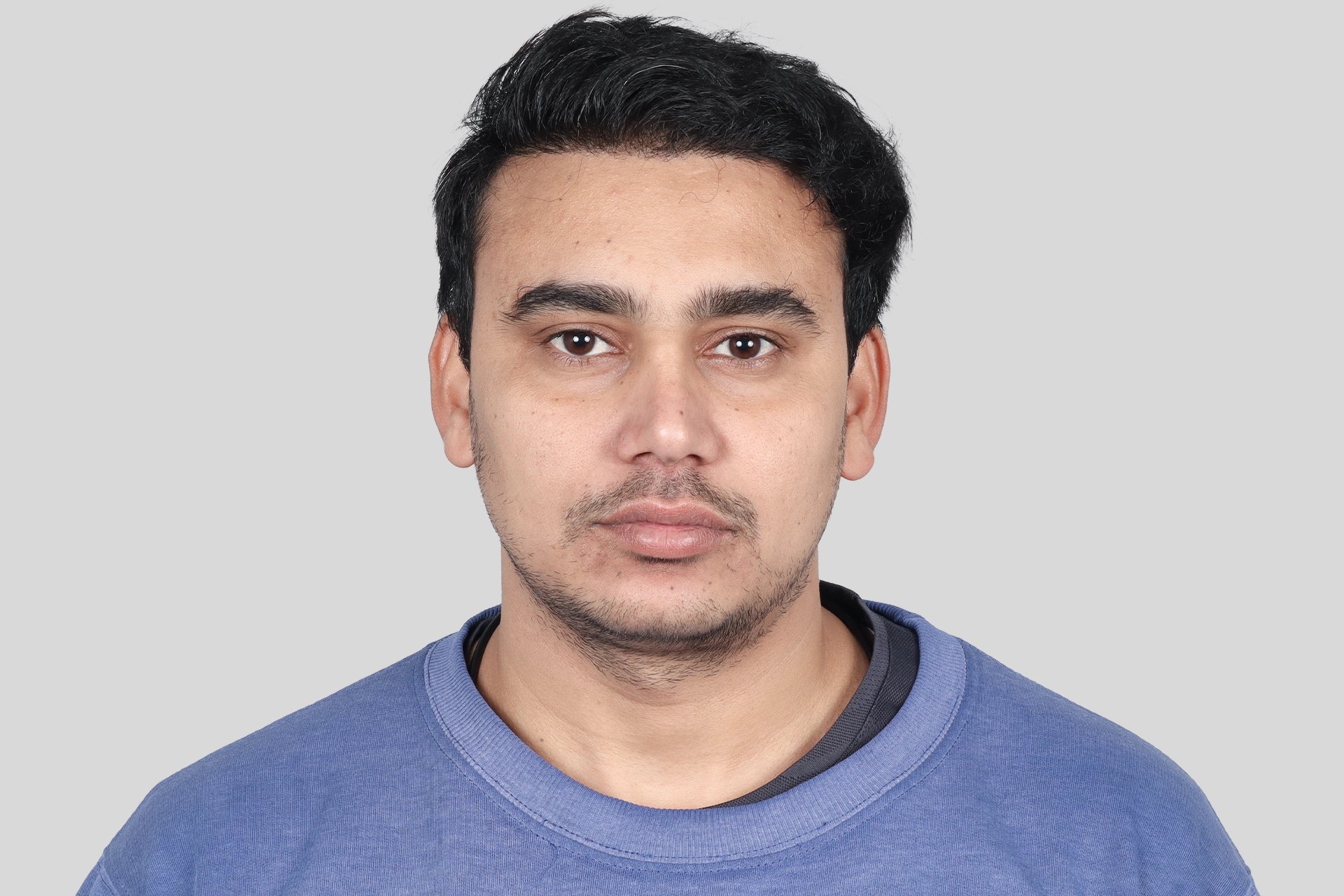 After Transplant Image