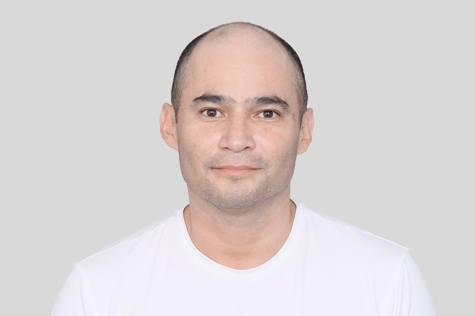 Before Transplant Image