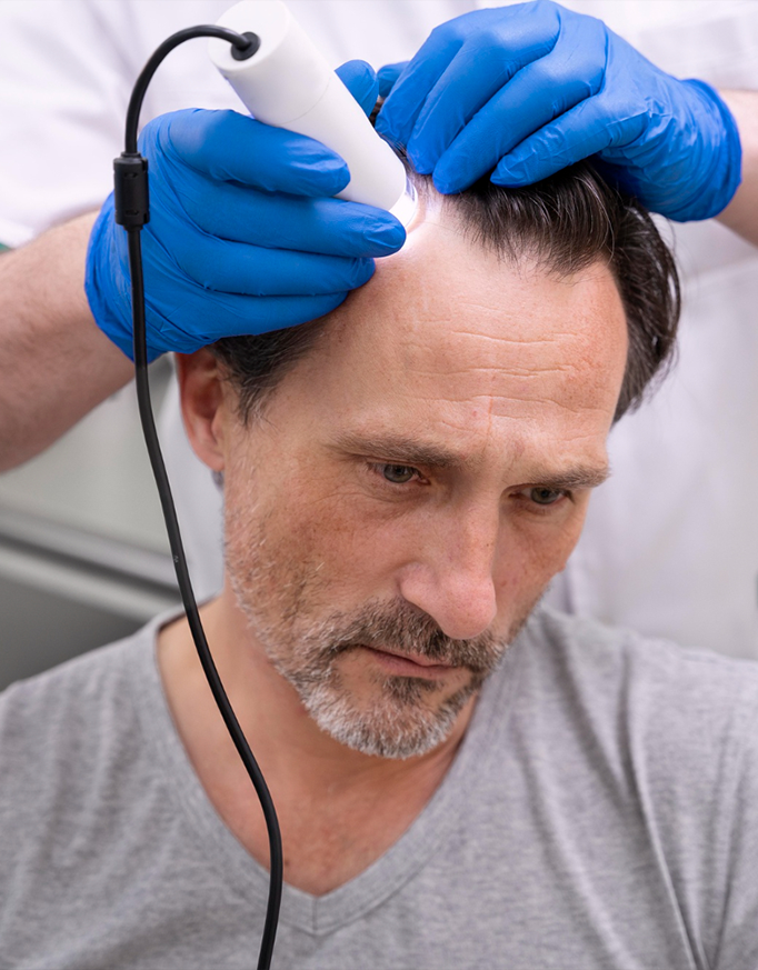Hair Transplant: Process and Recovery Timeline
