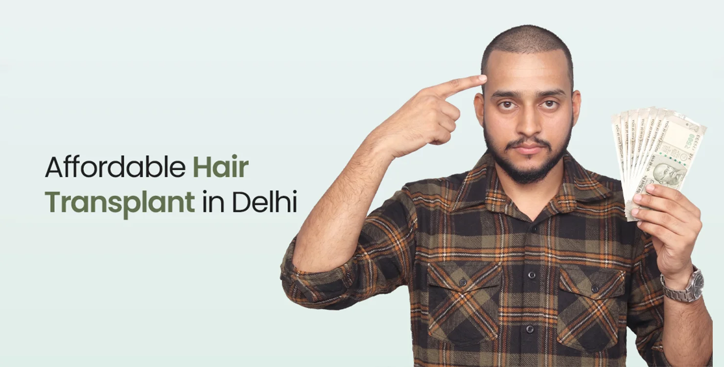 Affordable hair transplant in Delhi