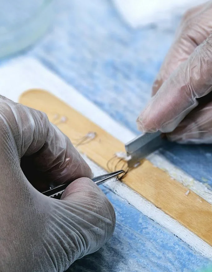 Graft Price Delhi Clinics Quote: What Influences It?