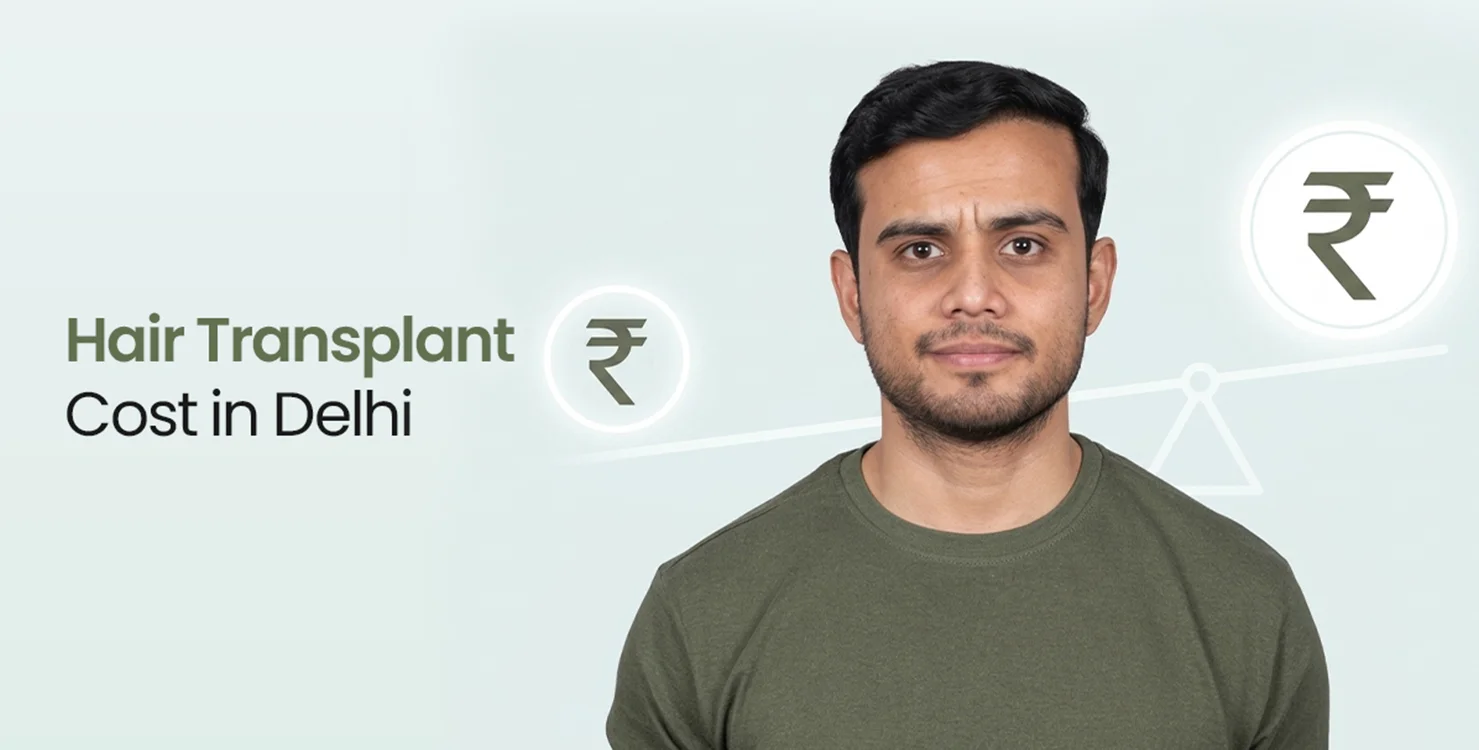 Hair Transplant Cost in Delhi