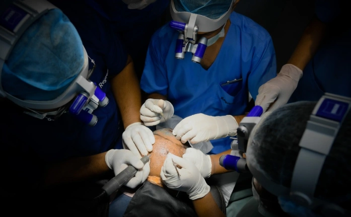 Understanding Hair Transplant Price Delhi Clinics Offer