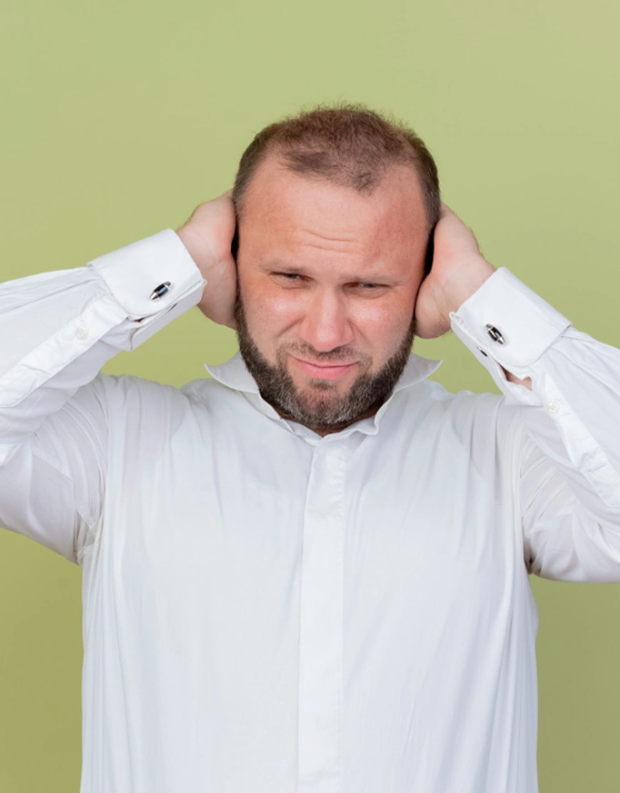 Understanding Grade 3 Hair Transplant in Delhi