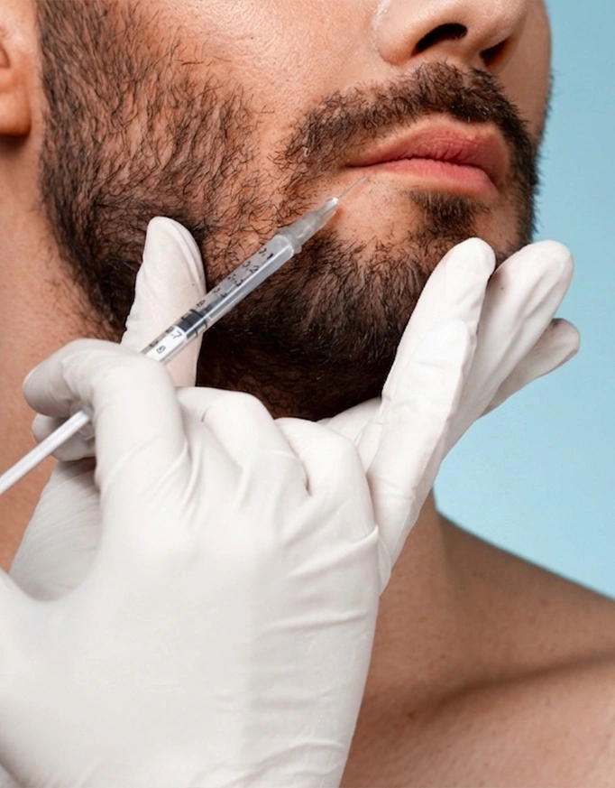 Understanding Beard Hair Transplant in Delhi