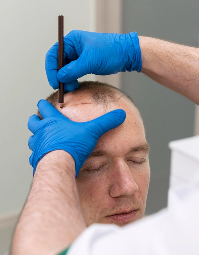Hair Transplant Guide: Cost, Safety, and Best Clinics