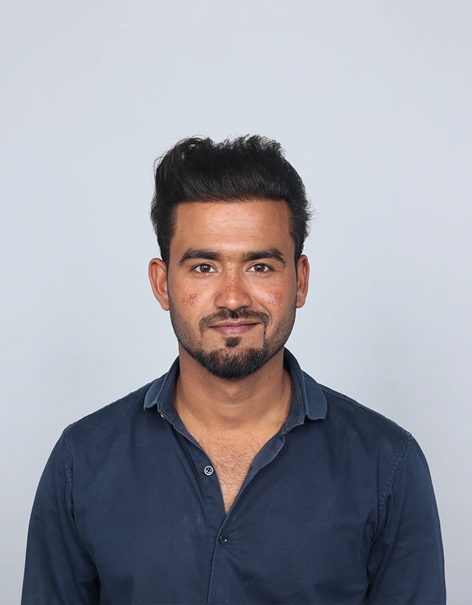 Understanding Hair Transplant Results in Delhi
