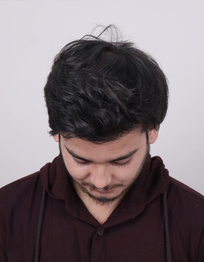 Hair Growth and Results – What Should You Expect?