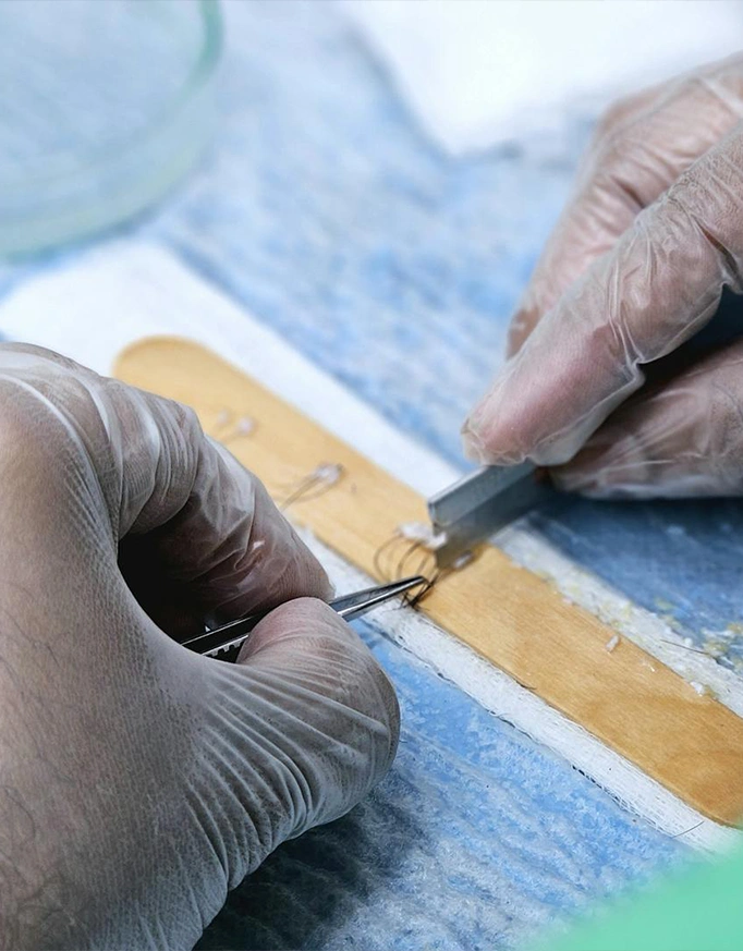 What is a hair graft?