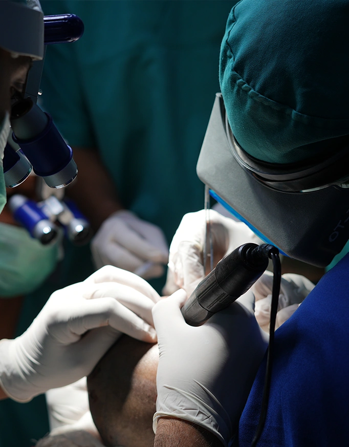 Differences Between Beard and Scalp Hair Transplant