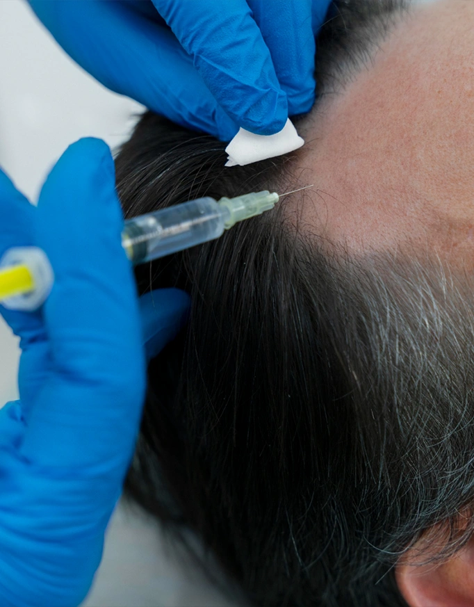 Is a hair transplant procedure painful?