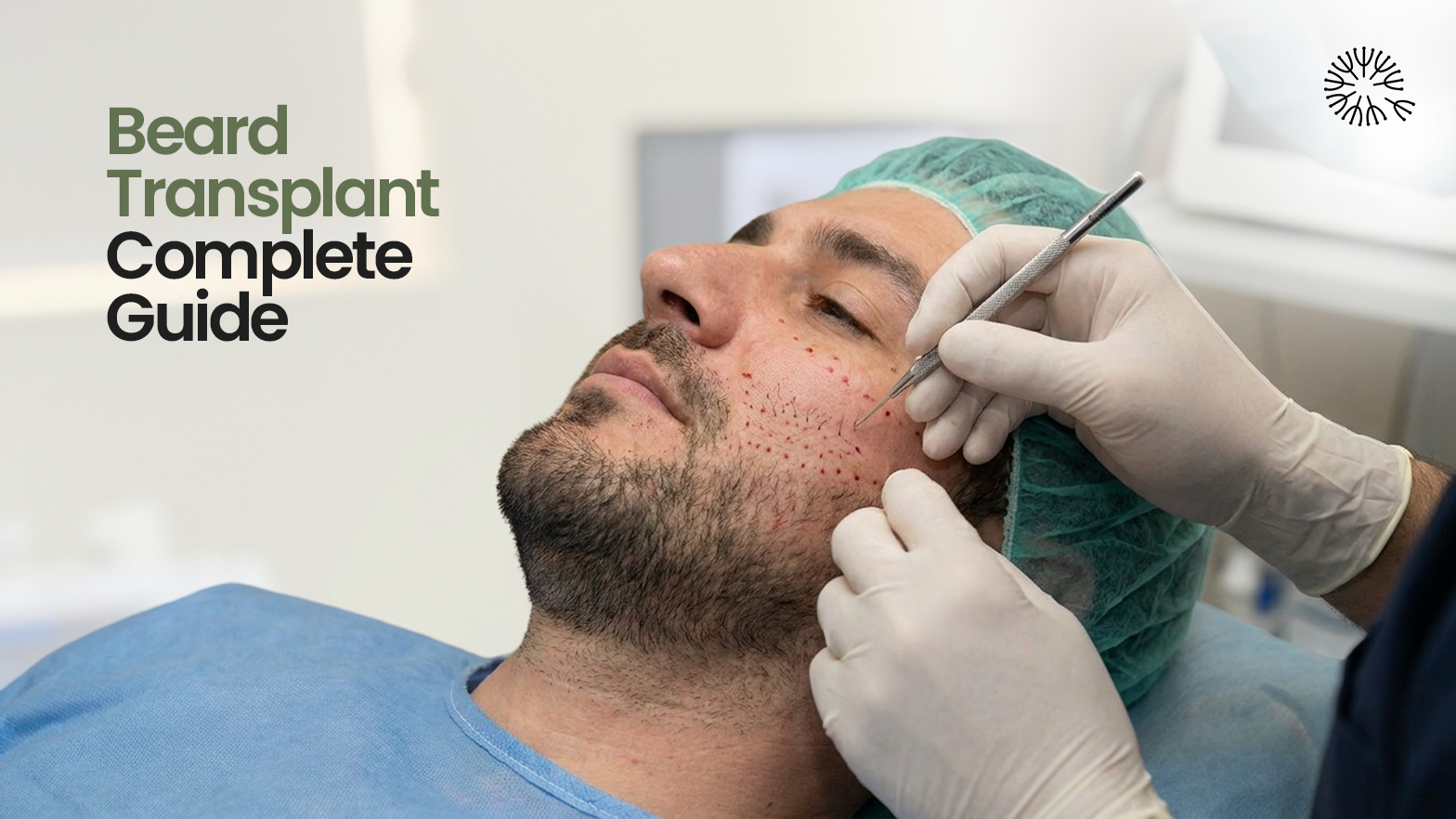 Beard Transplant Complete Guide