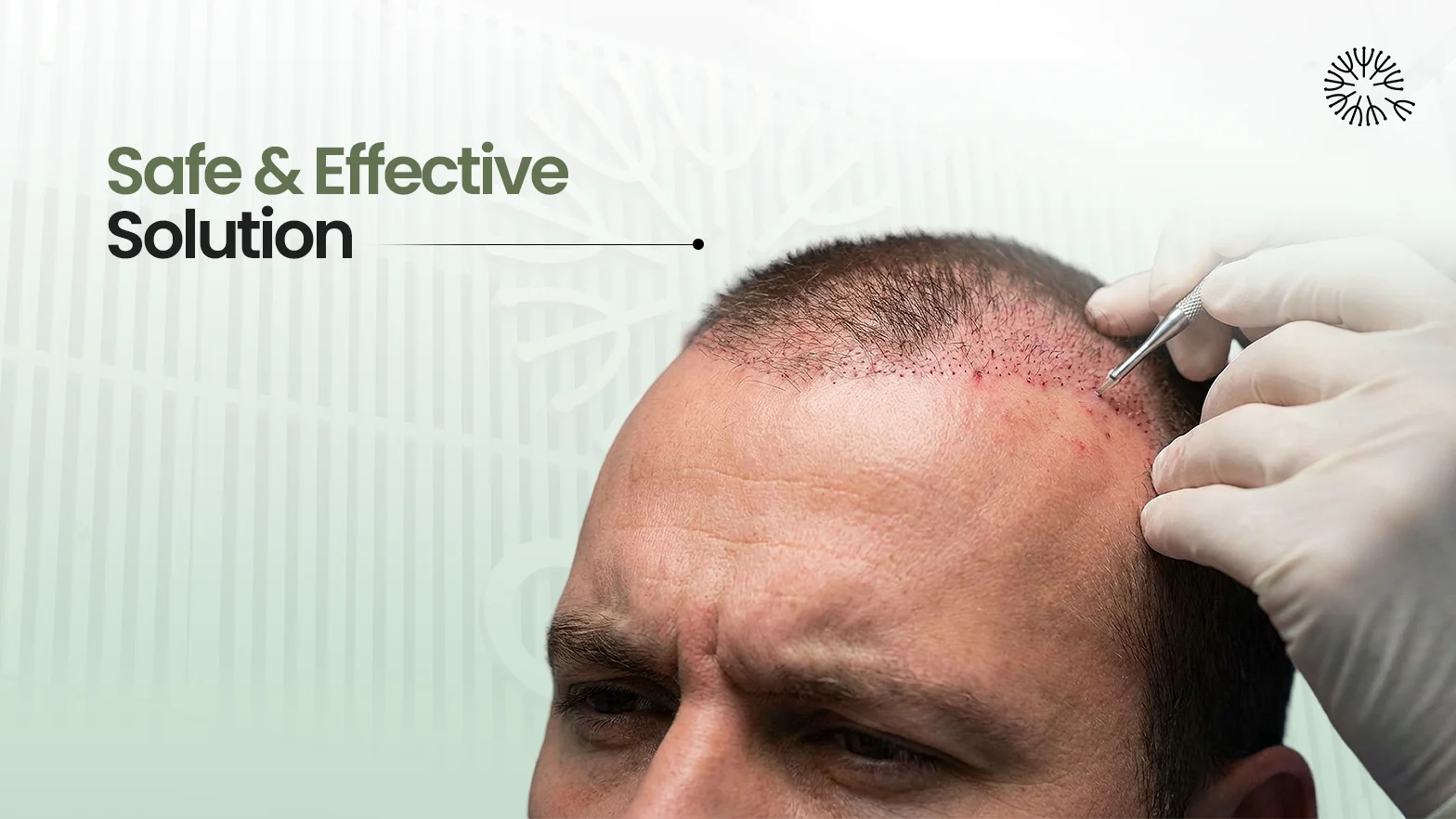 Is Hair Transplant Painful?