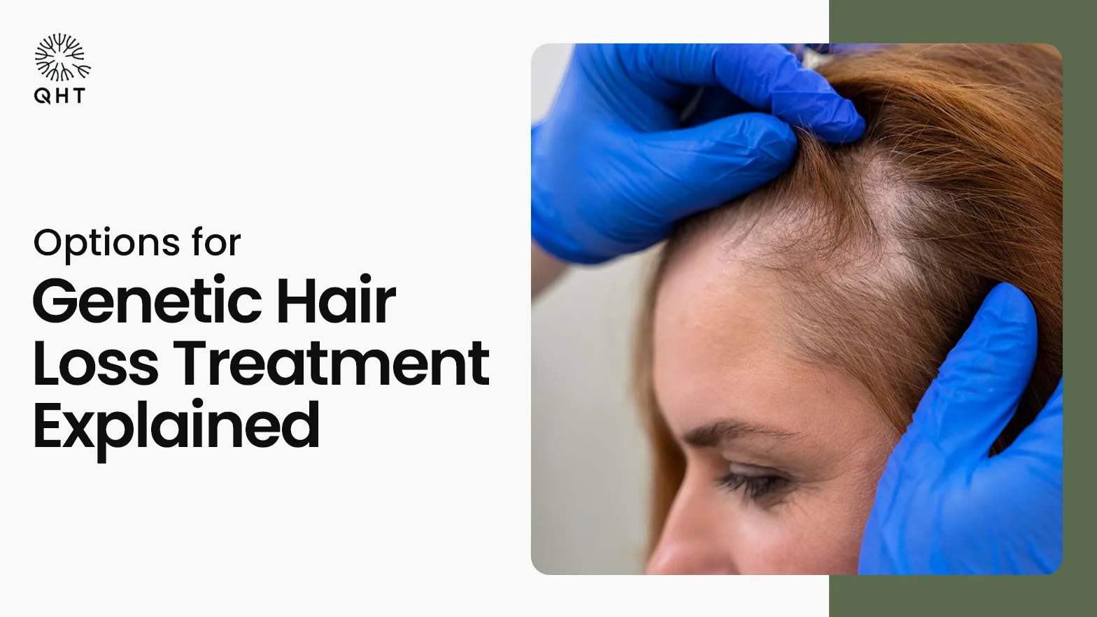 What are the Effective Hair Loss Treatments for Genetic Baldness?