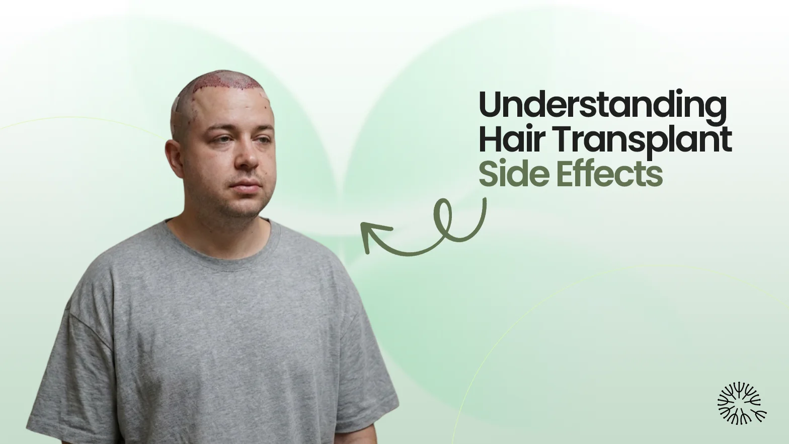 Hair transplant Side effects