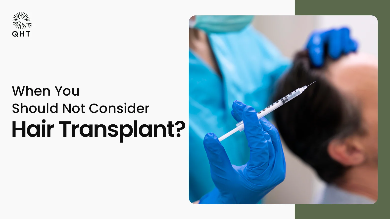 When You Should Not Consider Hair Transplant