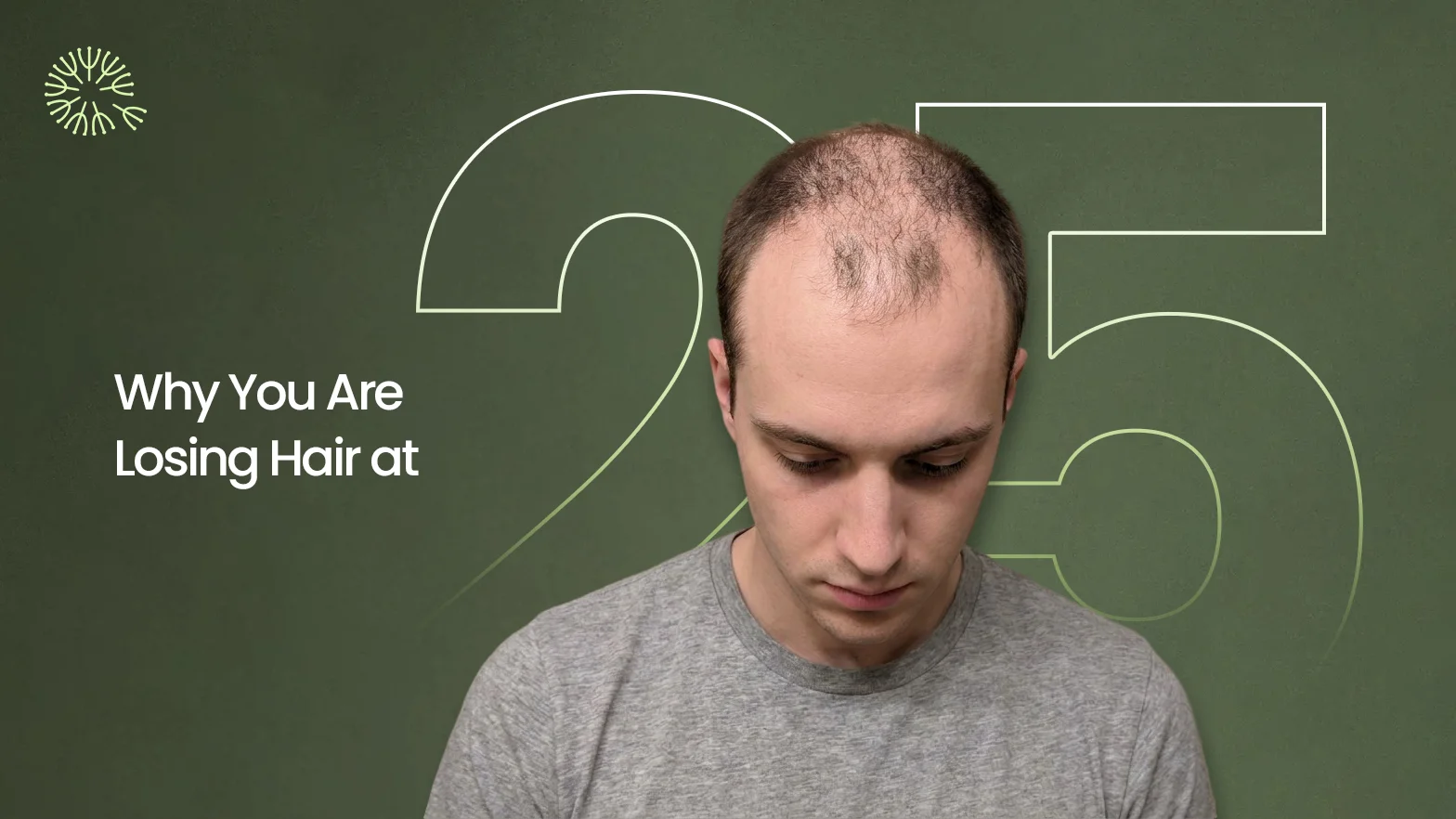 Why You Are Losing Hair at 25