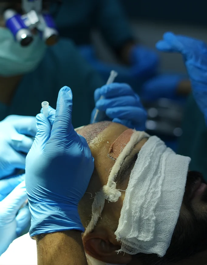 Comparison: FUE vs Other Hair Transplant Techniques