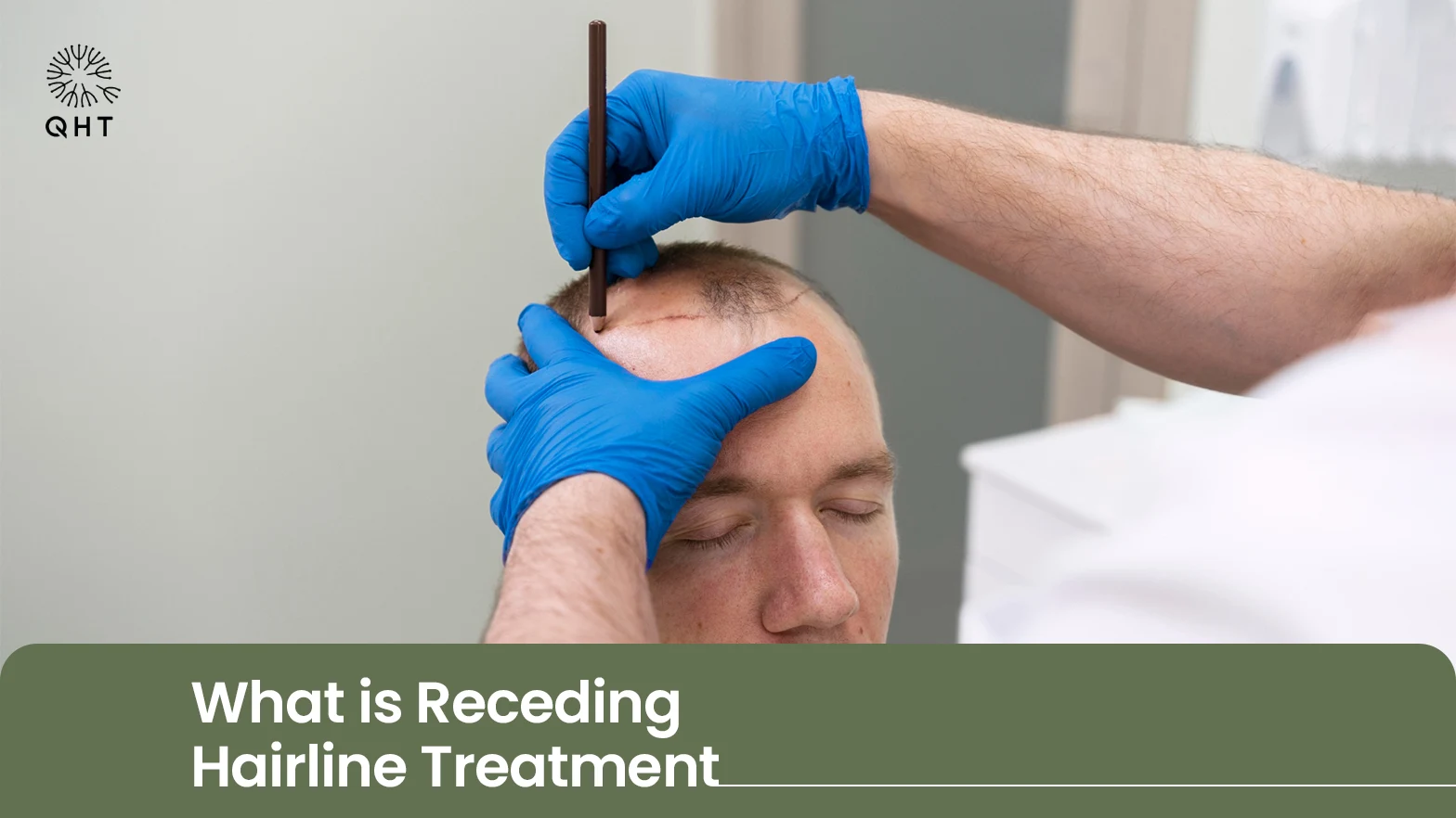 Effective Treatments for a Receding Hairline