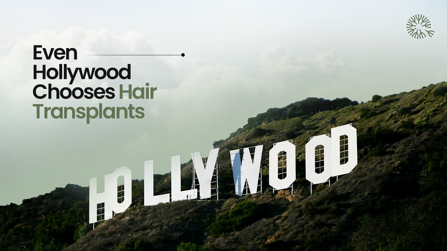 10 Hollywood Celebrities With Hair Transplants You Didn’t Know