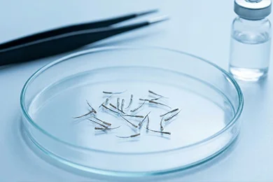 Personalised Graft Assessment