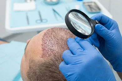 Strategic Graft Placement