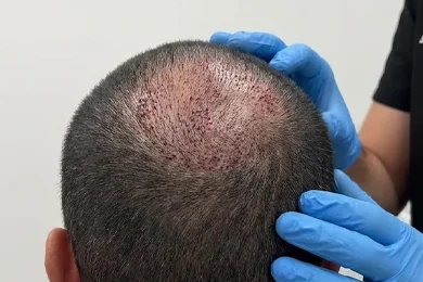 Structured Post-Op Care