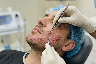 Surgeon-led Treatment