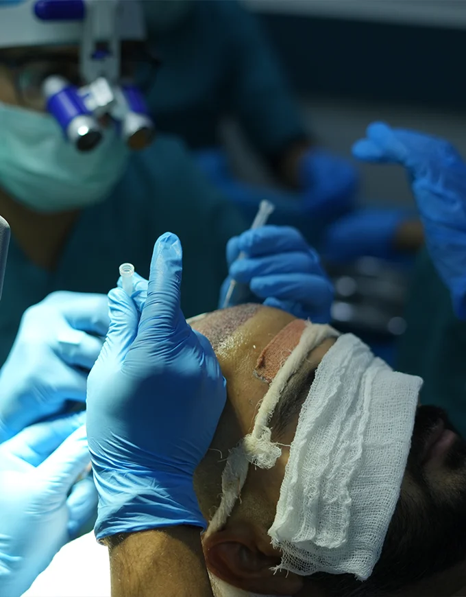 Is FUE Hair Transplant Worth the Cost? A Practical Perspective