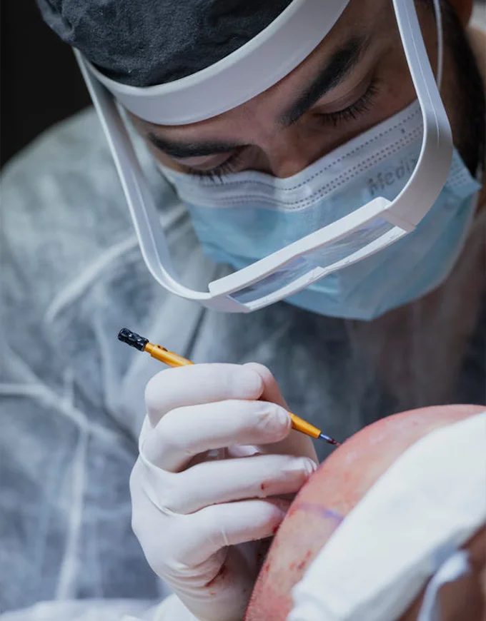 The Average Indicative FUT, QHT, and FUE Graft Cost in Gurgaon
