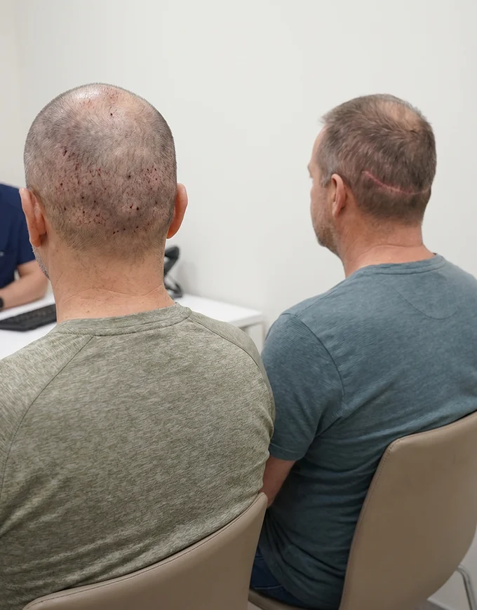 FUE vs FUT Difference in Gurgaon: Which is right for you?