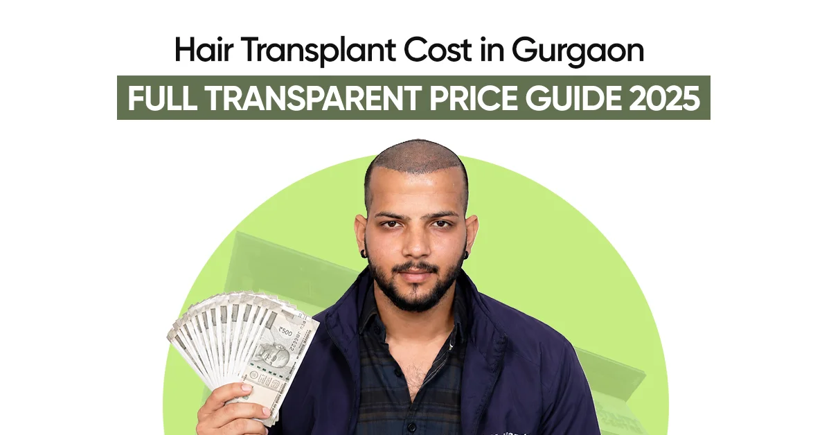 Hair Transplant Cost in Gurgaon