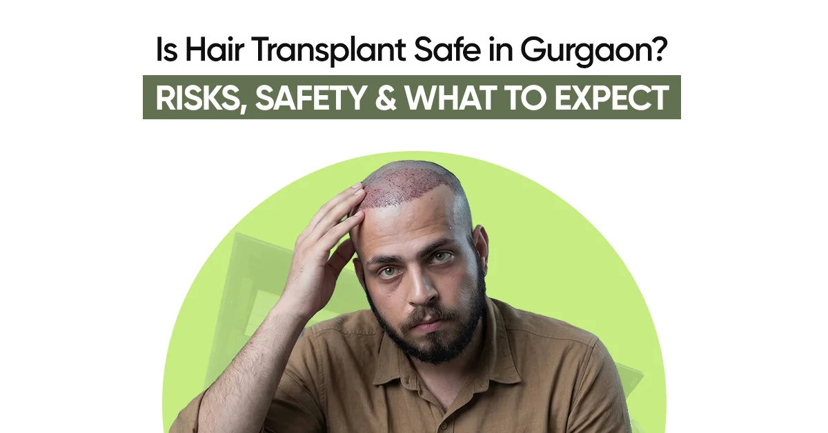 Is Hair Transplant Safe in Gurgaon