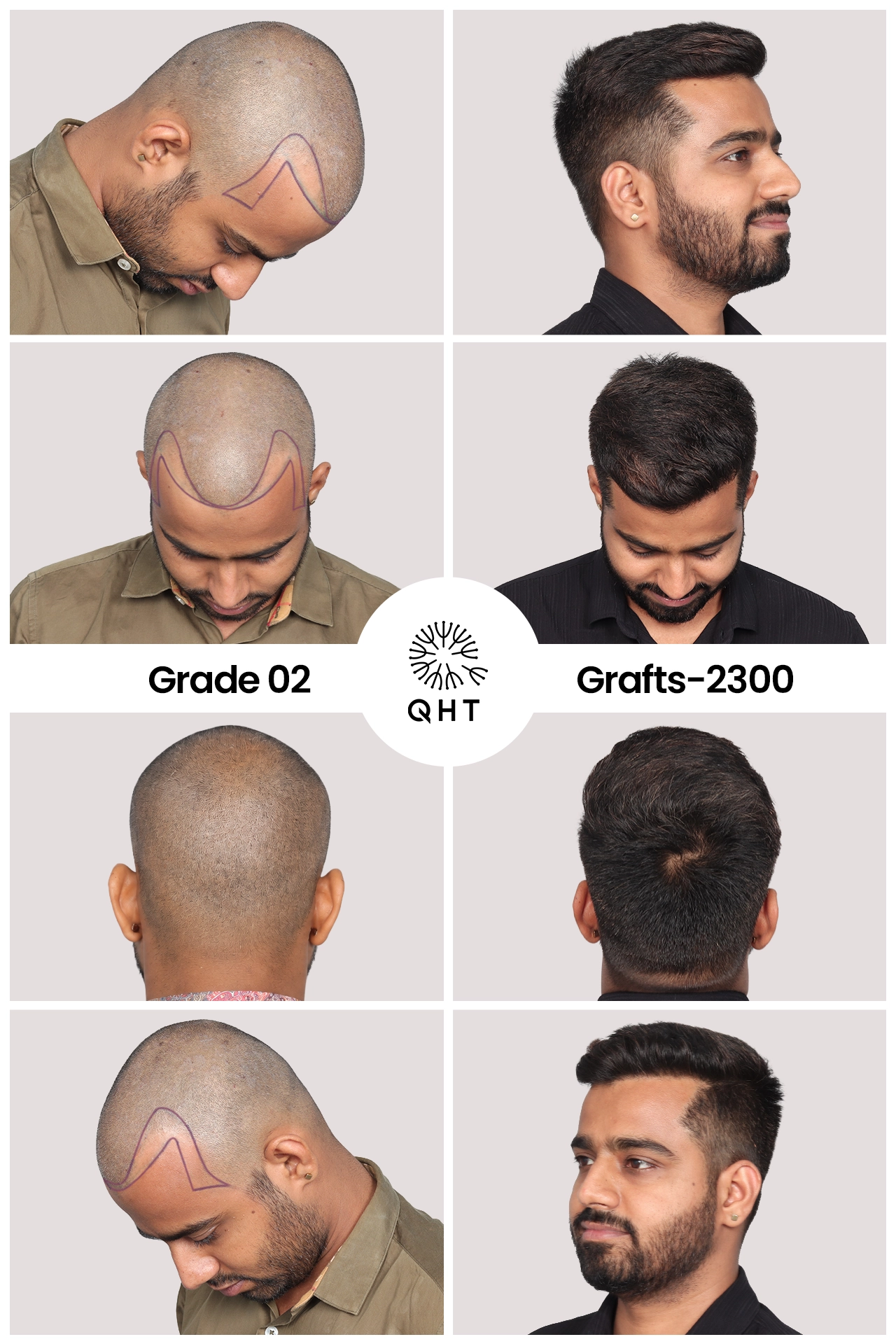 Praveen Kumar Case Study Image