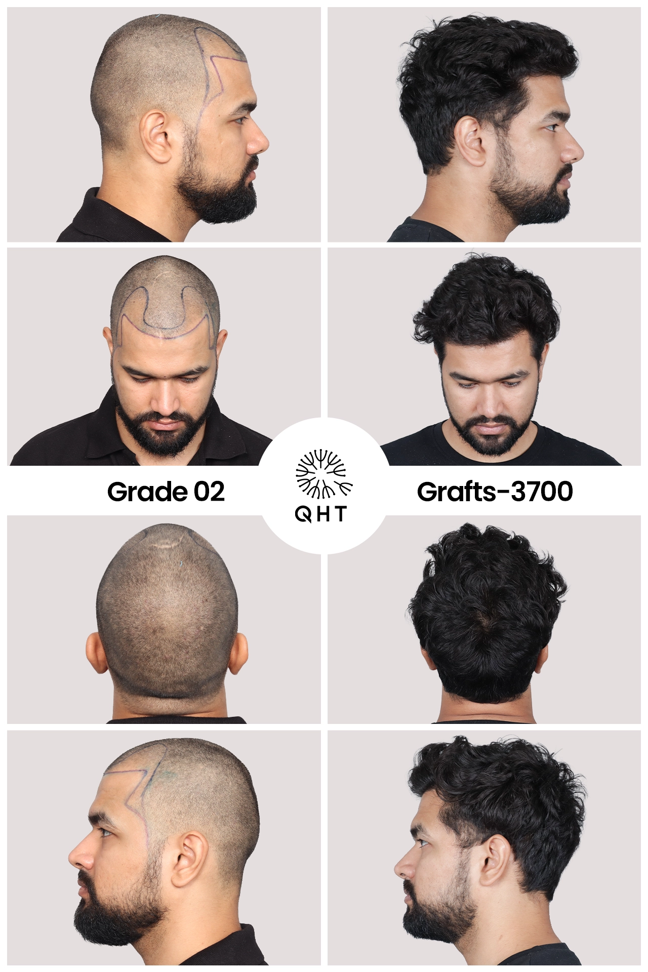 Shubham Kataria  Case Study Image